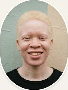 Remi Osei